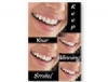 Recall Card - Keep Your Winning Smile Postcard 4-Up (200)